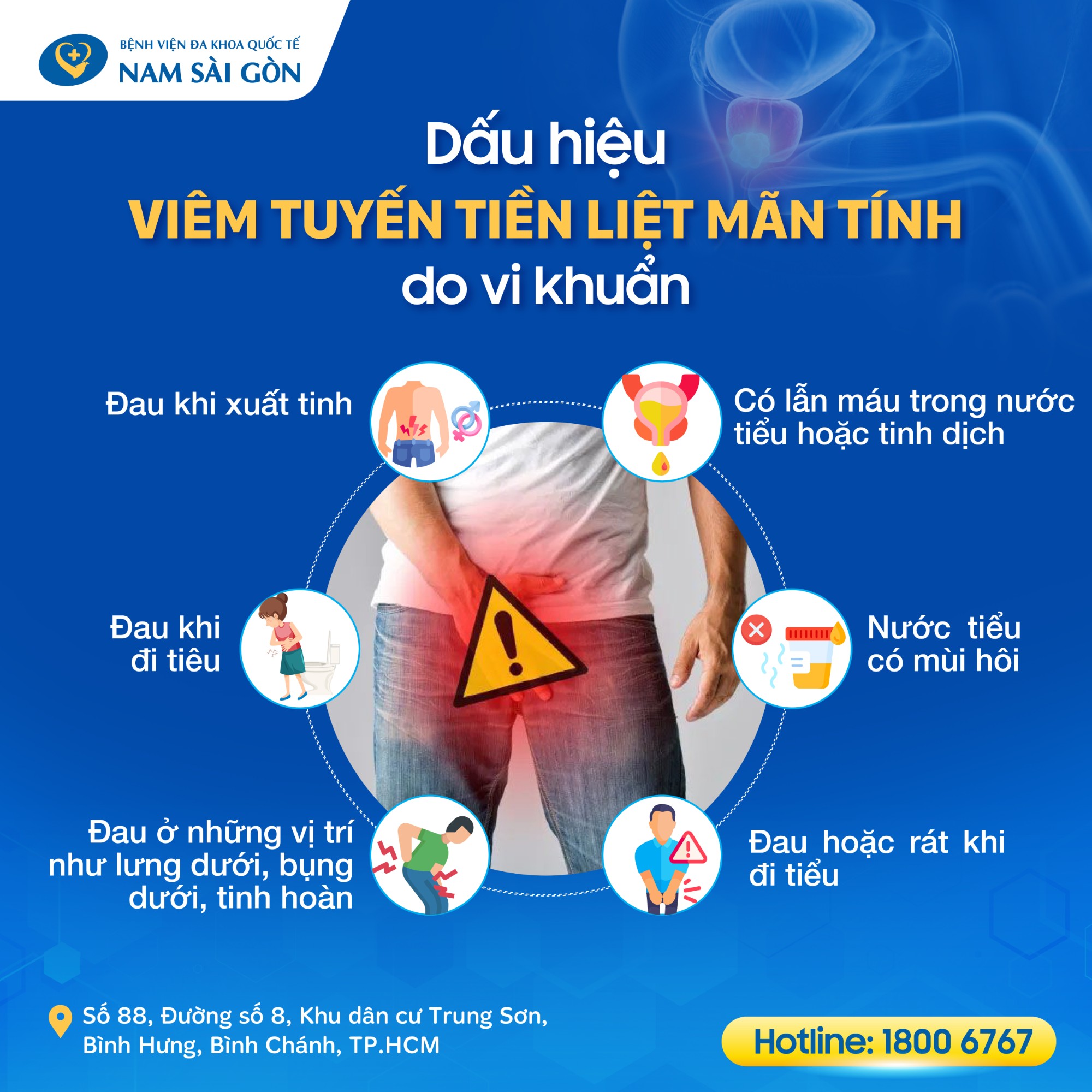 dau_hieu_viem_tuyen_tien_liet_01 Triệu chứng viêm tuyến tiền liệt mãn tính