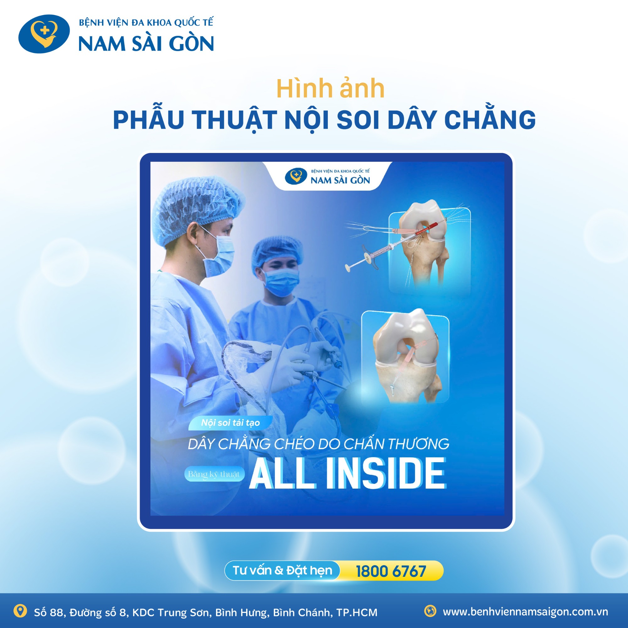 hinh_2_noi_soi_day_chang_01-1