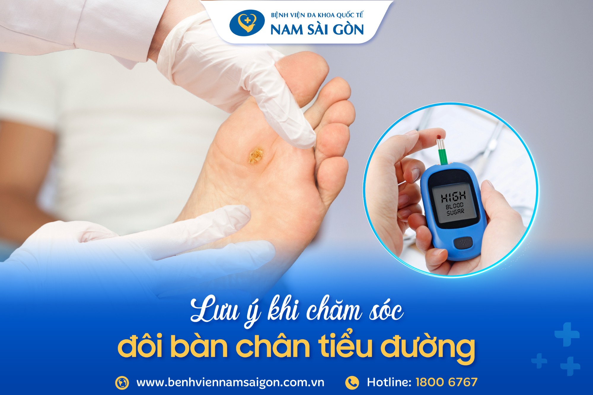 cách chăm sóc bàn chân tiểu đường cách chăm sóc bàn chân tiểu đường