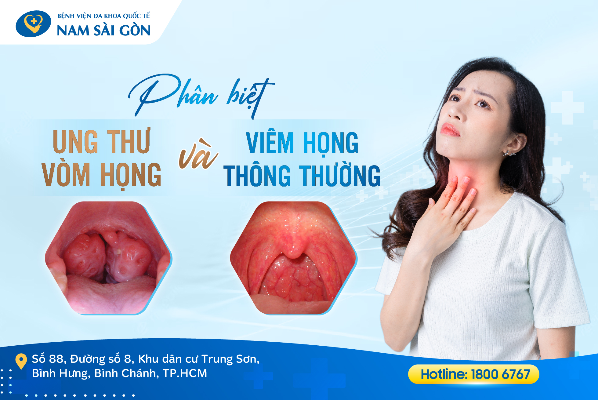 UNG THƯ VÒM HỌNG VÀ VIÊM HỌNG KHÁC NHAU NHƯ THẾ NÀO?
