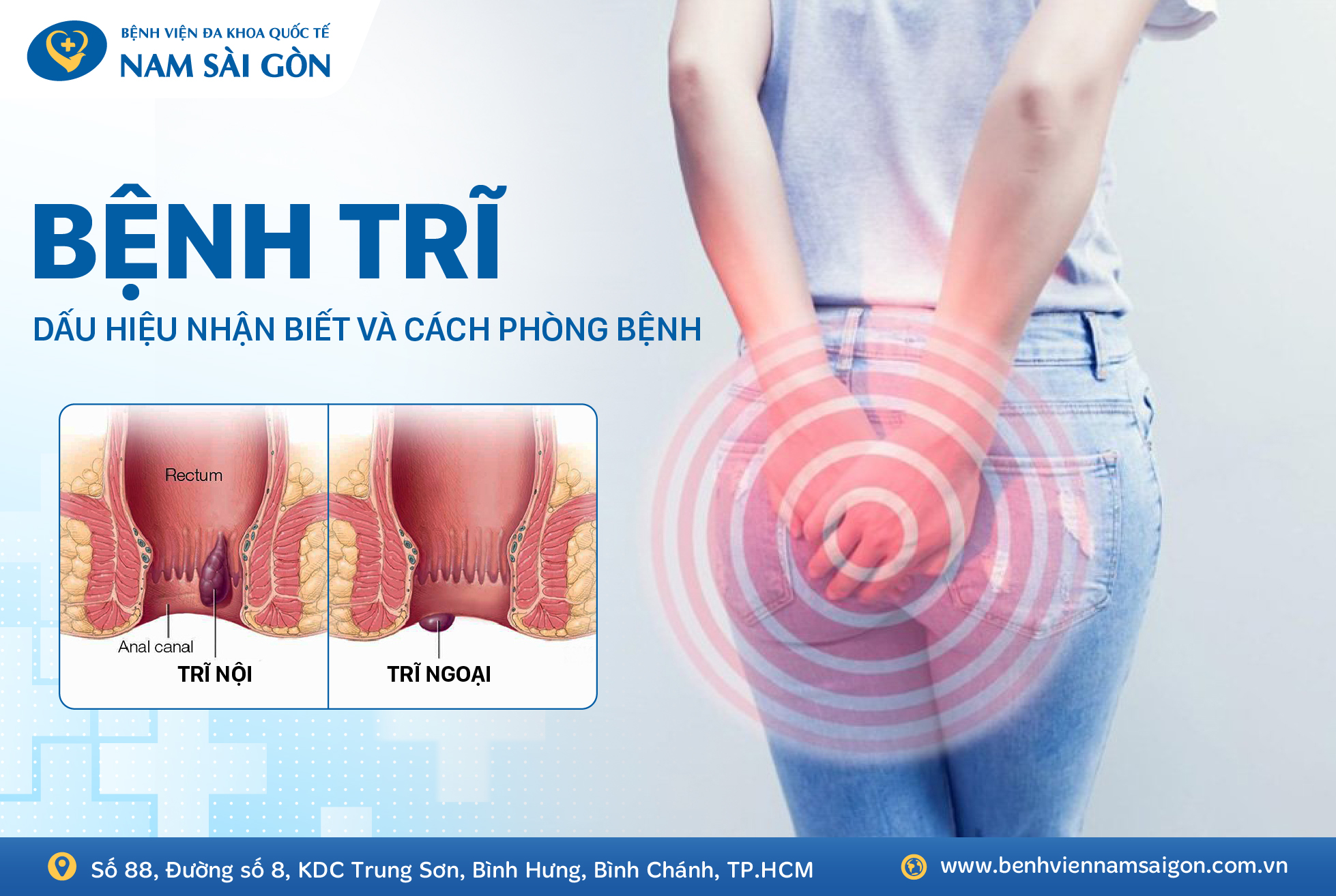 BỆNH TRĨ – DẤU HIỆU, BIẾN CHỨNG VÀ CÁCH PHÒNG BỆNH
