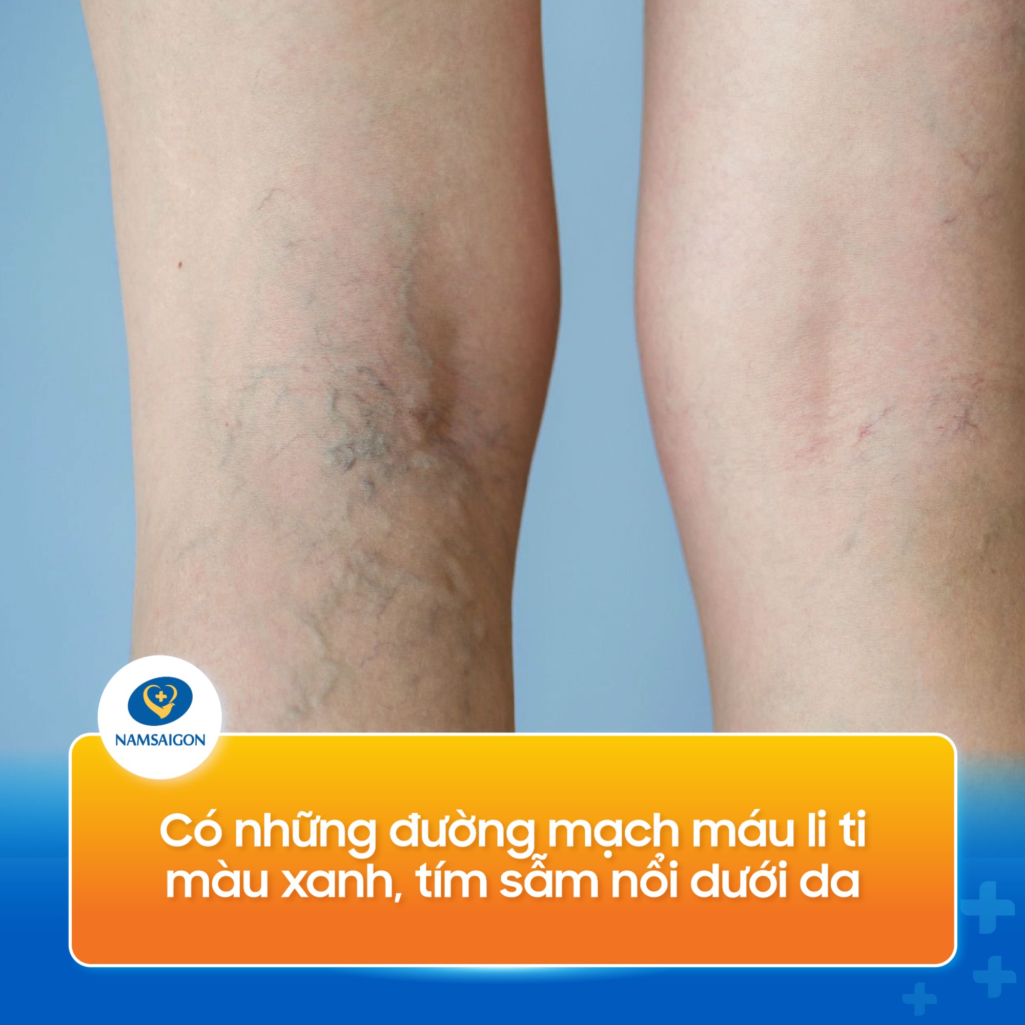 suy_gian_tinh_mach_chan_08