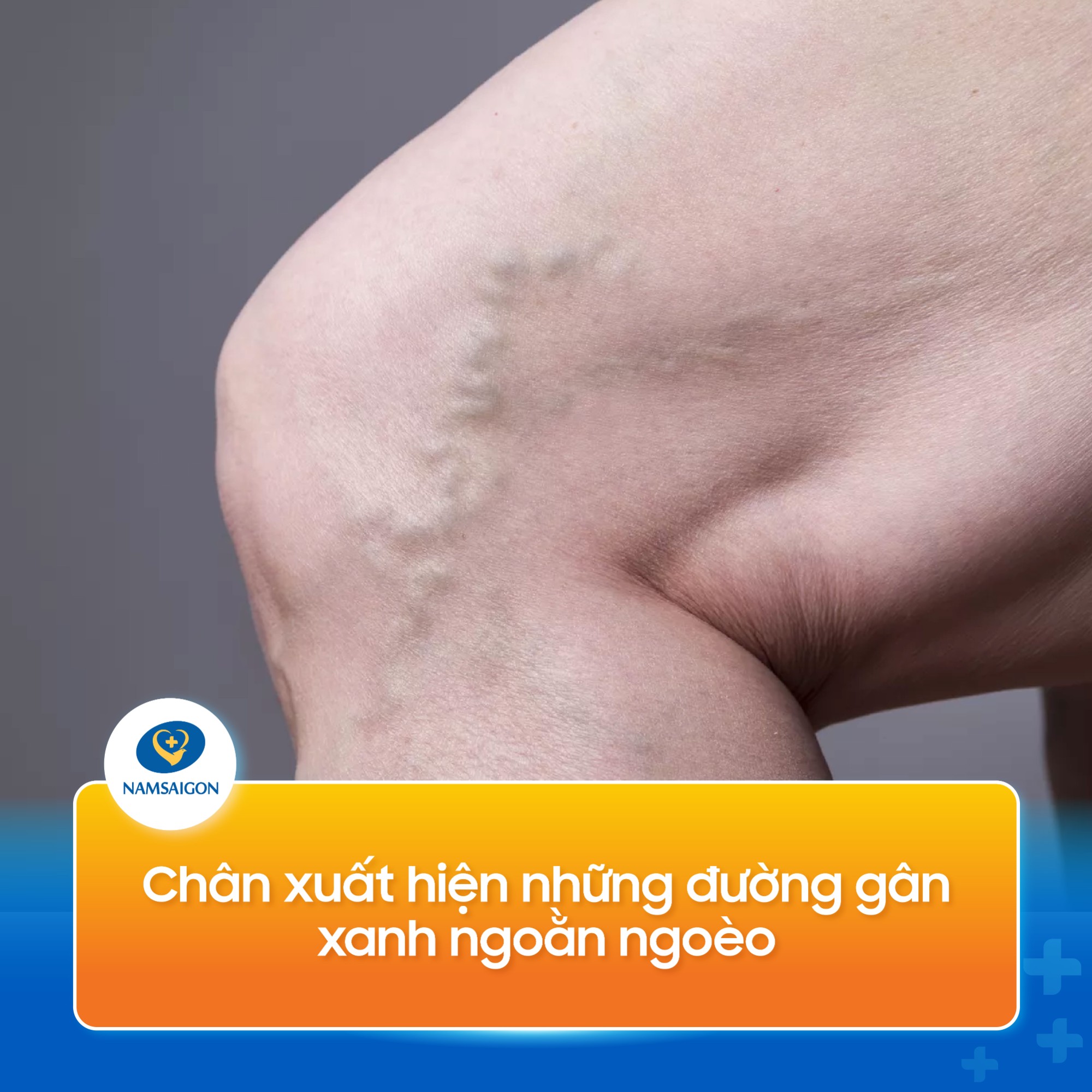 suy_gian_tinh_mach_chan_09