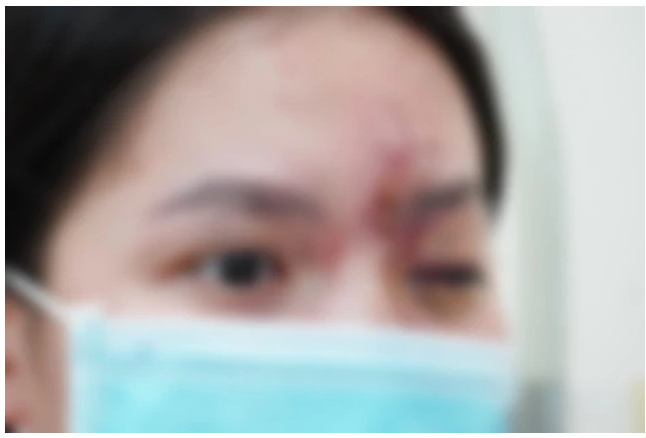 HÀNG LOẠT CA TAI BIẾN THẨM MỸ, BÁC SĨ KHUYẾN CÁO GÌ KHI ĐI LÀM ĐẸP?