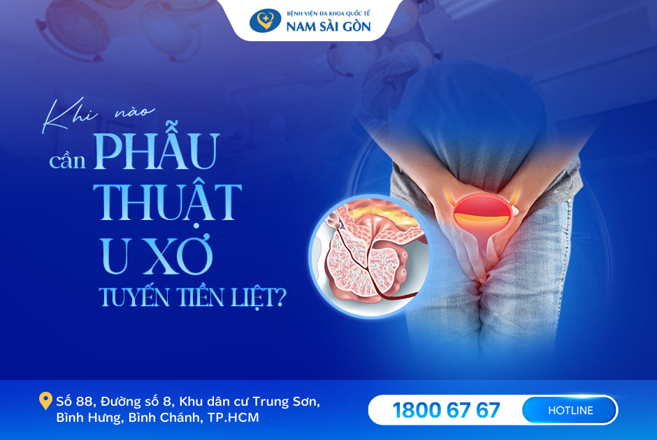 KHI NÀO CẦN PHẪU THUẬT U XƠ TUYẾN TIỀN LIỆT?