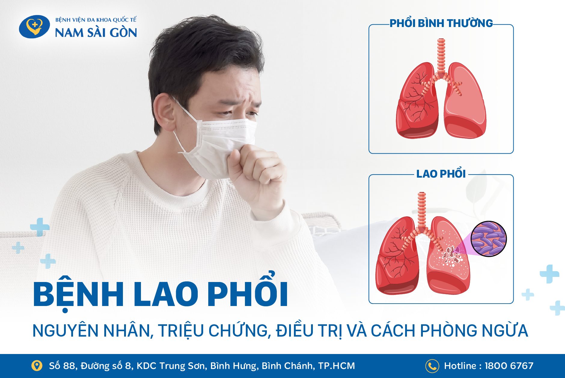 BỆNH LAO PHỔI – NGUYÊN NHÂN, TRIỆU CHỨNG VÀ CÁCH ĐIỀU TRỊ
