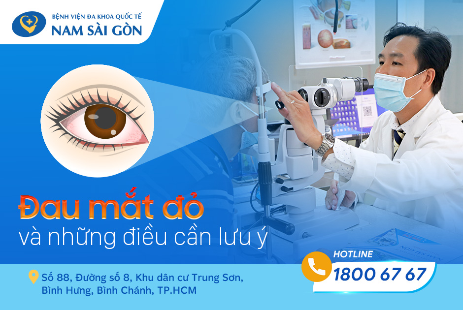 BỆNH ĐAU MẮT ĐỎ: DẤU HIỆU, NGUYÊN NHÂN, BIẾN CHỨNG VÀ CÁCH ĐIỀU TRỊ