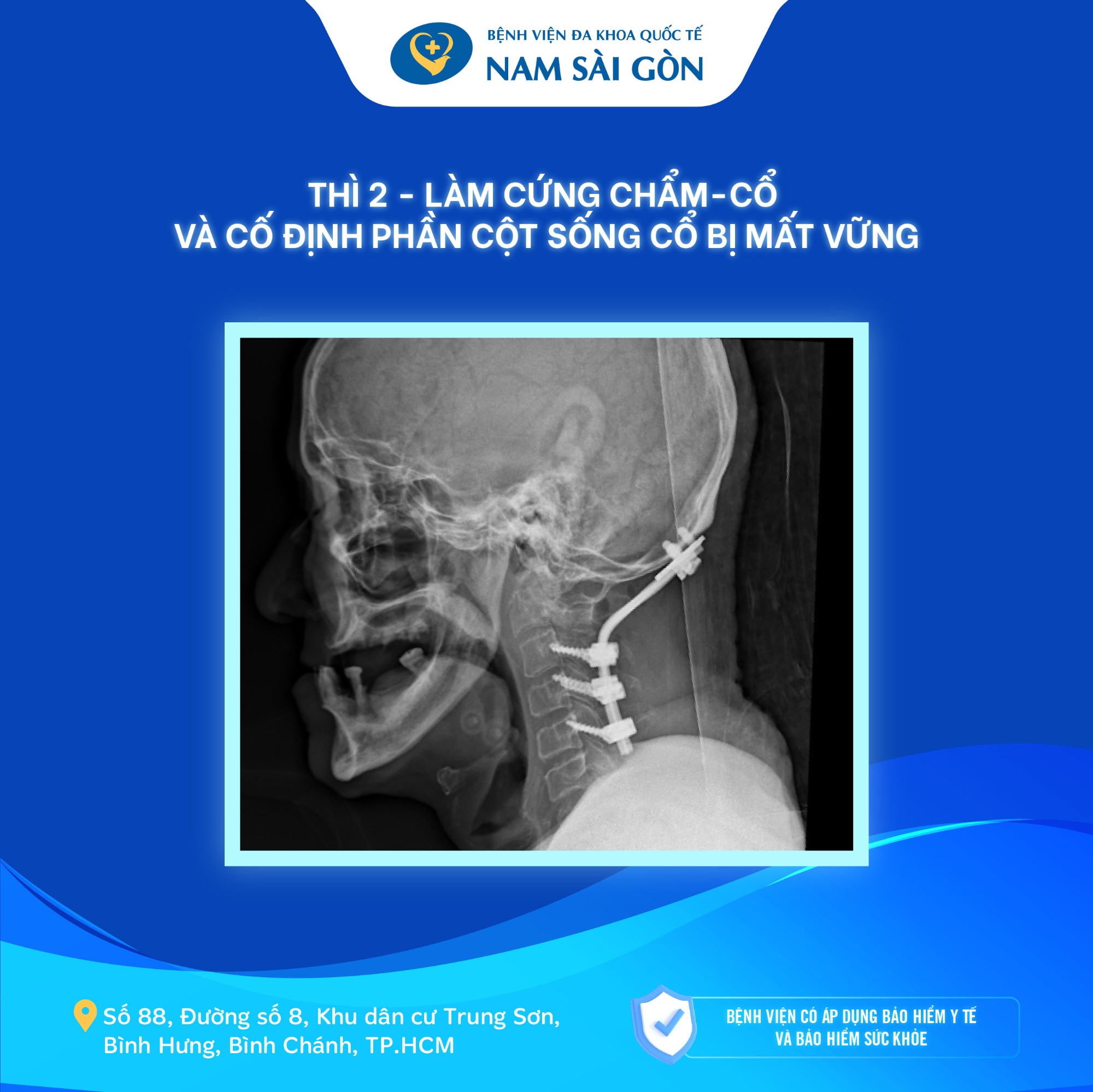 u_nao_01_4-3 u nao 01 4 3