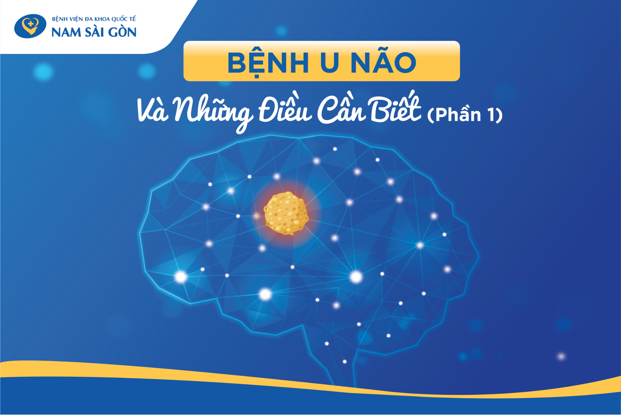 U NÃO: NGUYÊN NHÂN, TRIỆU CHỨNG, CÁCH CHẨN ĐOÁN VÀ ĐIỀU TRỊ