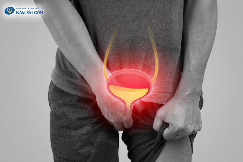 nguyên nhân viêm bàng quang ở nam giới