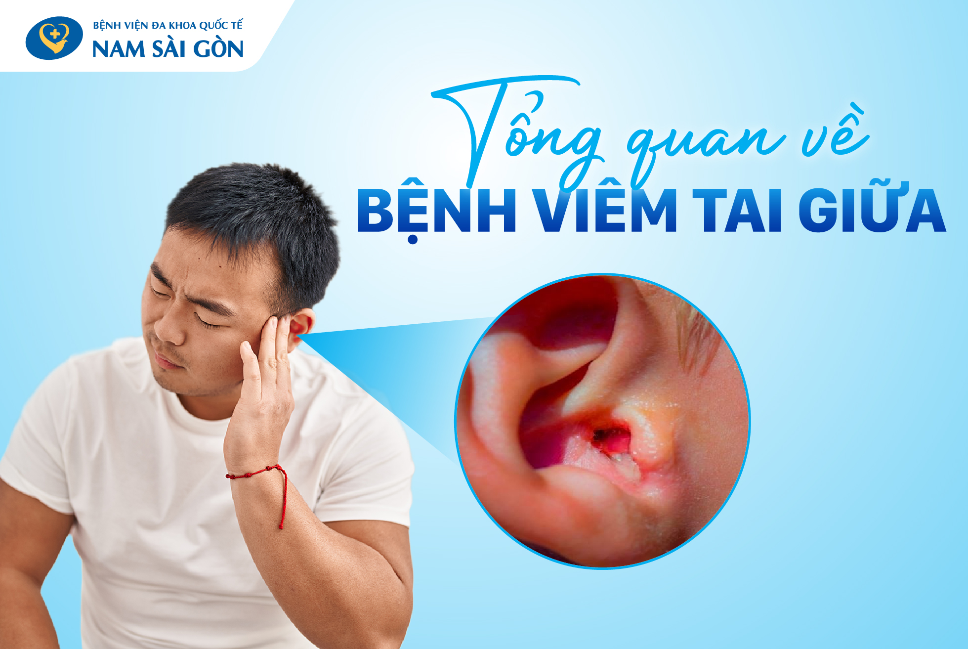 VIÊM TAI GIỮA – NGUYÊN NHÂN, DẤU HIỆU, CHẨN ĐOÁN, ĐIỀU TRỊ VÀ PHÒNG NGỪA