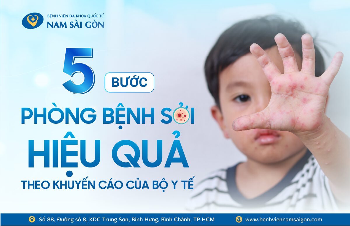 5 BƯỚC PHÒNG BỆNH SỞI HIỆU QUẢ – THEO KHUYẾN CÁO BỘ Y TẾ