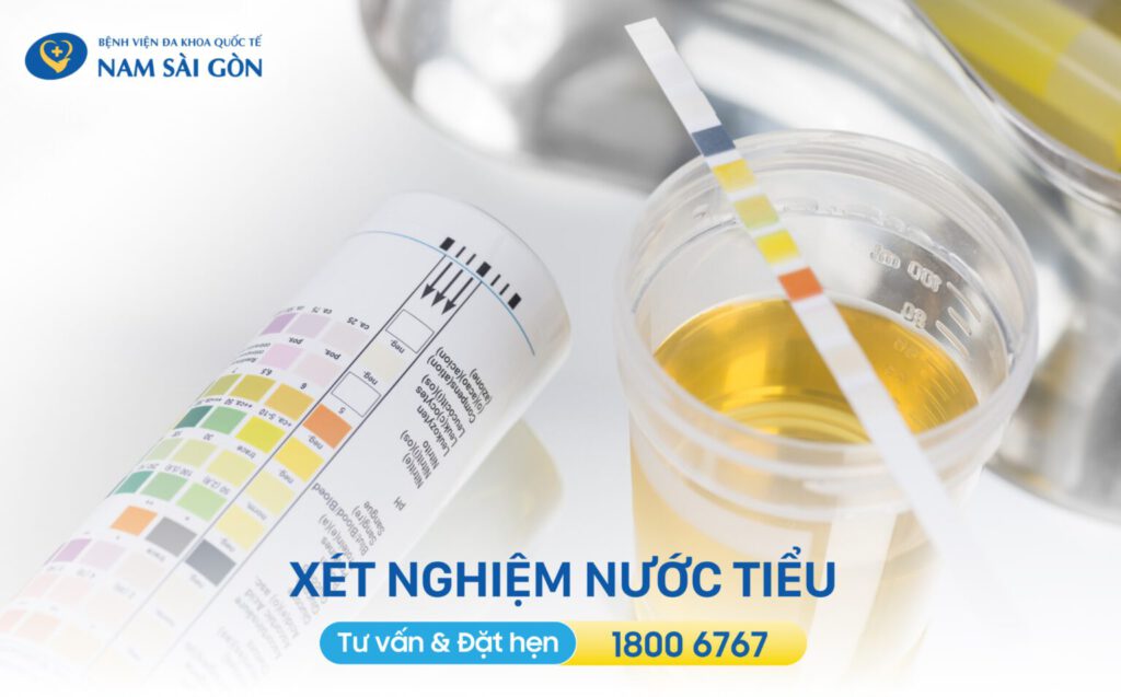 viêm bàng quang ở nữ giới viêm bàng quang nữ