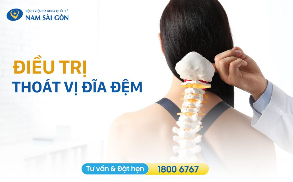 điều trị thoát vị đĩa đệm