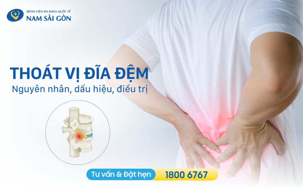 thoát vị đĩa đệm là gì