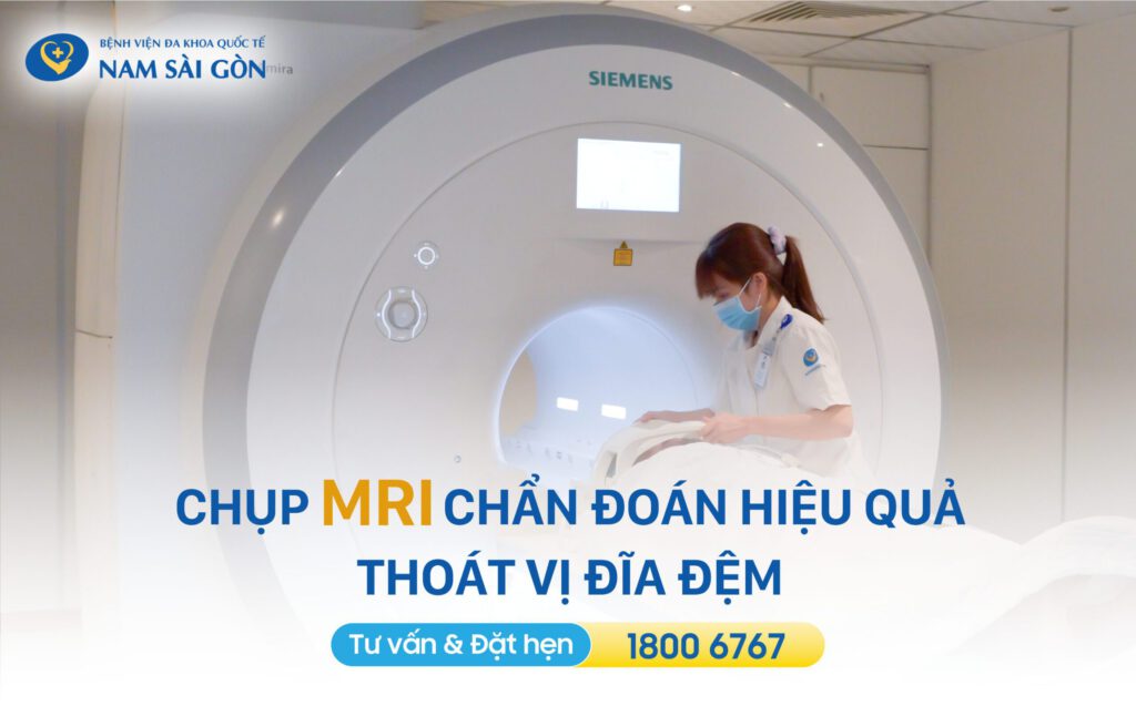 dấu hiệu thoát vị đĩa đệm