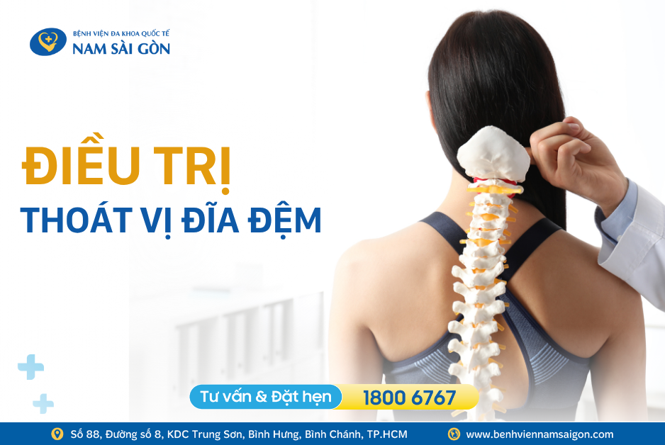 ĐIỀU TRỊ THOÁT VỊ ĐĨA ĐỆM – PHƯƠNG PHÁP VÀ PHÒNG NGỪA HIỆU QUẢ