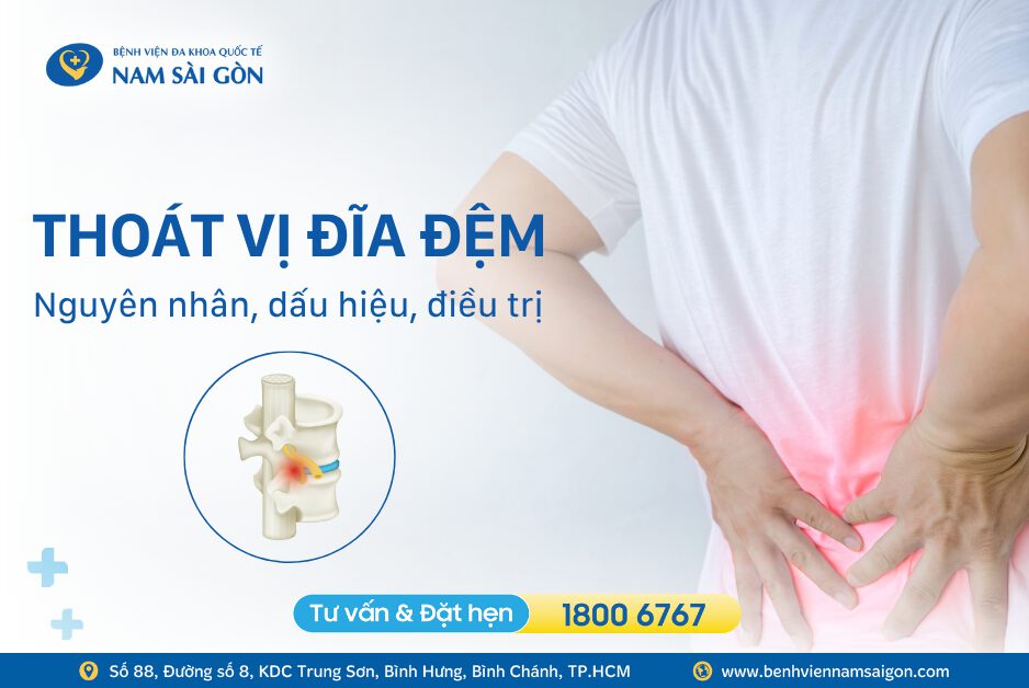 THOÁT VỊ ĐĨA ĐỆM – NGUYÊN NHÂN, DẤU HIỆU VÀ CÁCH ĐIỀU TRỊ
