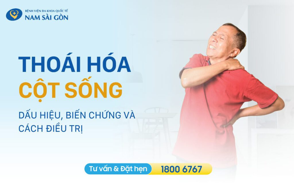 Thoái hóa cột sống là gì?