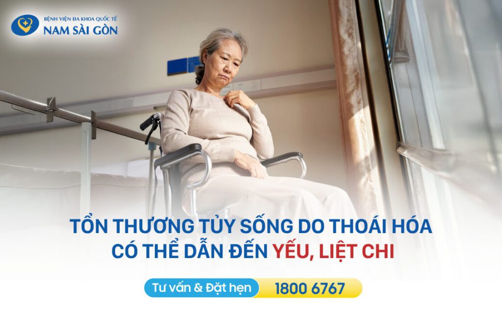 Thoái hóa cột sống có thể dẫn đến tổn thương tủy sống, gây ra biến chứng yếu liệt chi