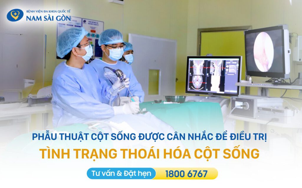 Phẫu thuật được cân nhắc để điều trị tình trạng thoái hóa cột sống khi điều trị bảo tồn không hiệu quả.