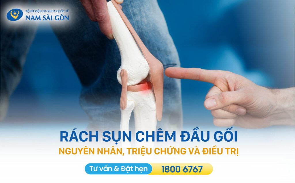 rach-sun-chem-dau-goi