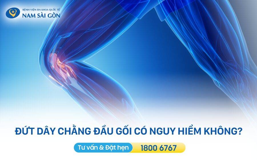 triệu chứng đứt dây chằng đầu gối