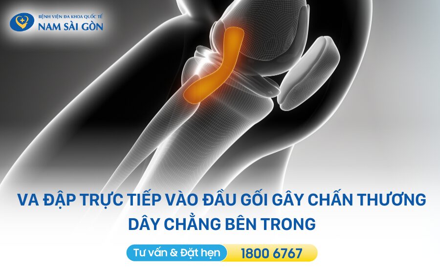 đứt dây chằng khớp gối