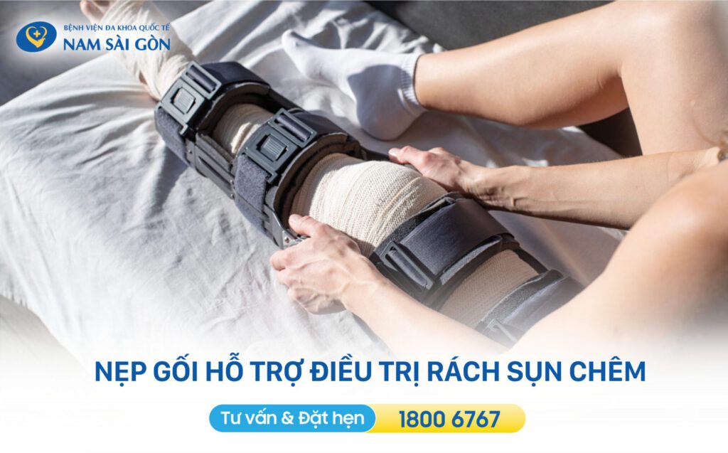 dieu-tri-rach-sun-chem-dau-goi