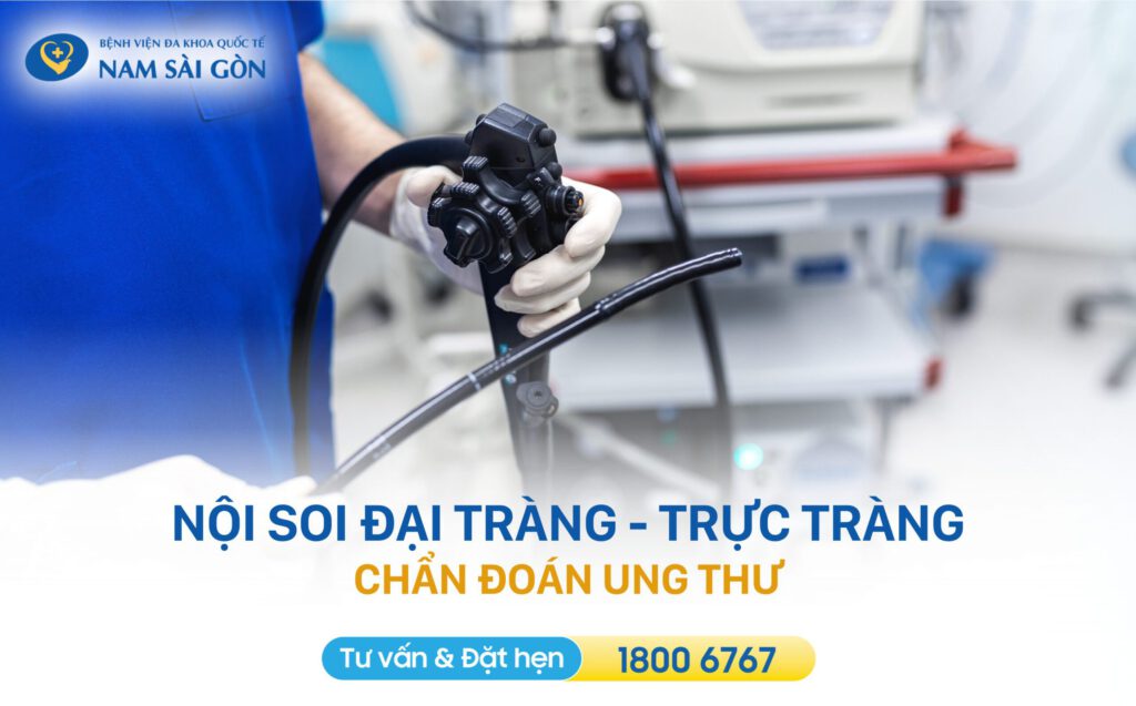 colon cancer là gì Chẩn đoán ung thư đại tràng