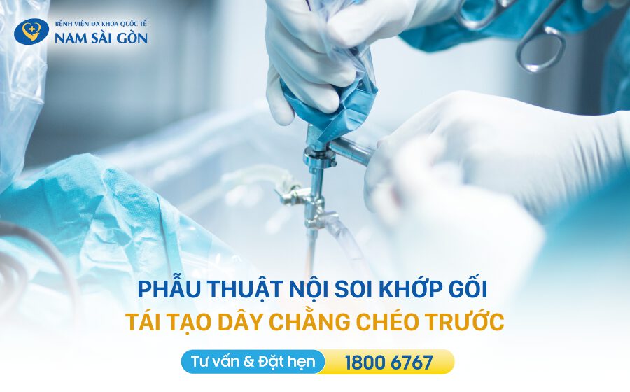 phẫu thuật nội soi đứt dây chằng chéo trước