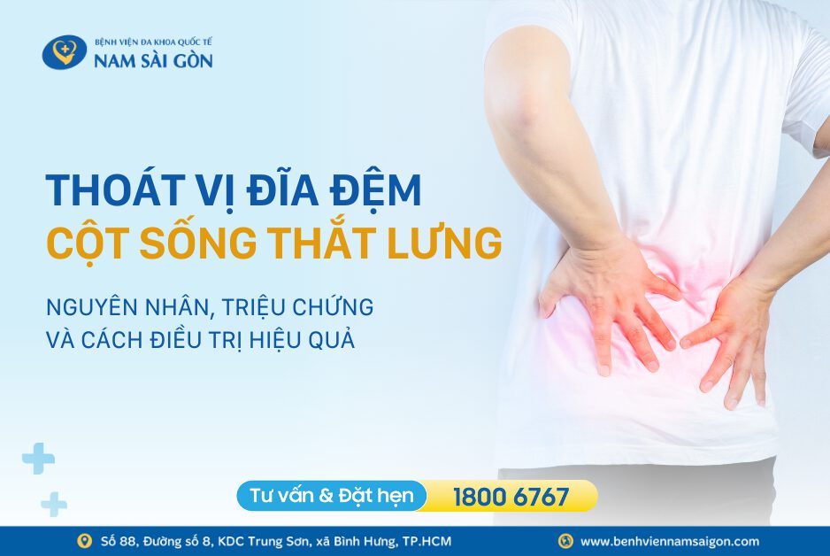 THOÁT VỊ ĐĨA ĐỆM CỘT SỐNG THẮT LƯNG: NGUYÊN NHÂN, TRIỆU CHỨNG VÀ CÁCH ĐIỀU TRỊ HIỆU QUẢ