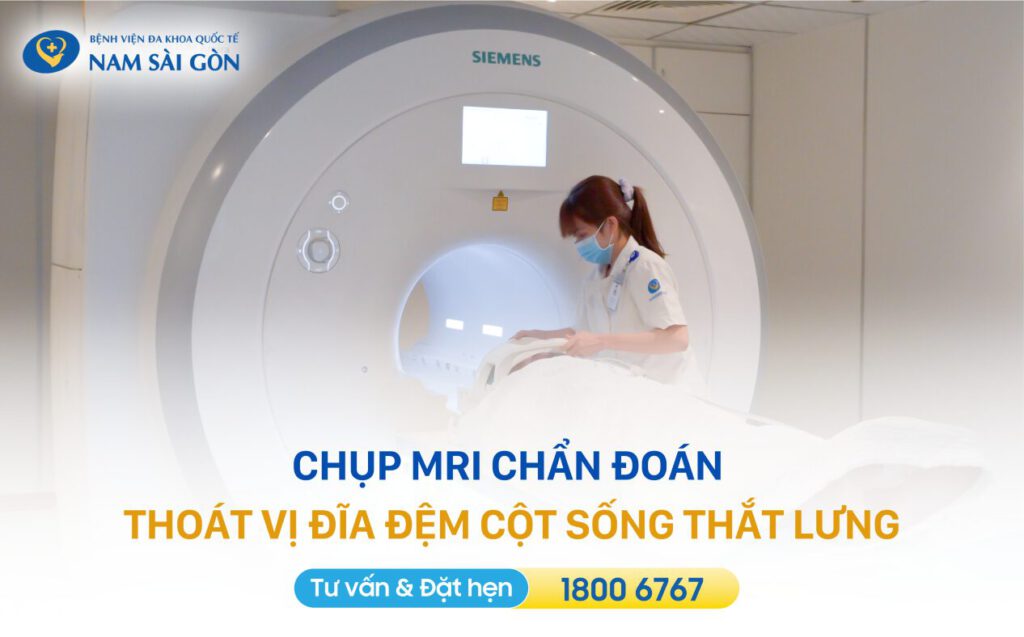 Chẩn đoán thoát vị đĩa đệm cột sống thắt lưng bằng cách nào