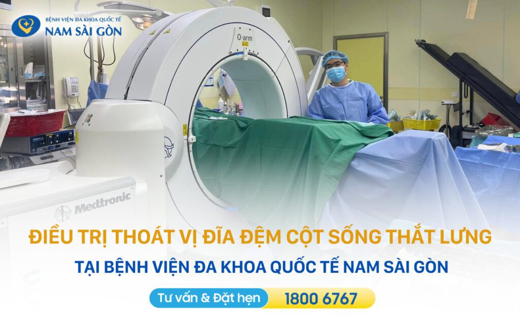 Điều trị thoát vị đĩa đệm cột sống thắt lưng