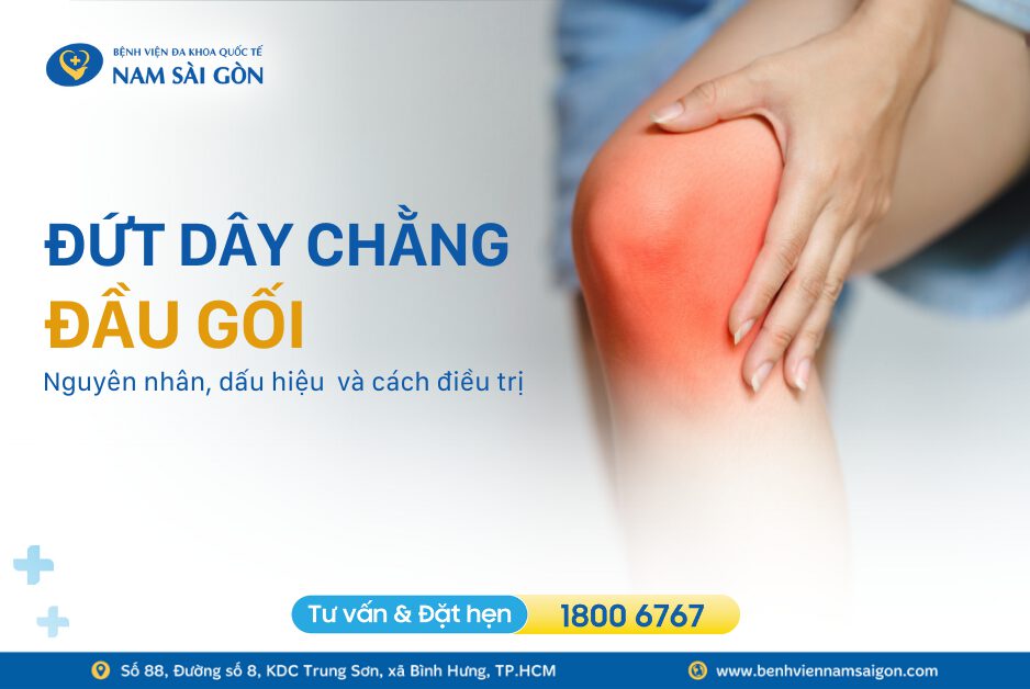 ĐỨT DÂY CHẰNG ĐẦU GỐI – NGUYÊN NHÂN, TRIỆU CHỨNG VÀ CÁCH ĐIỀU TRỊ
