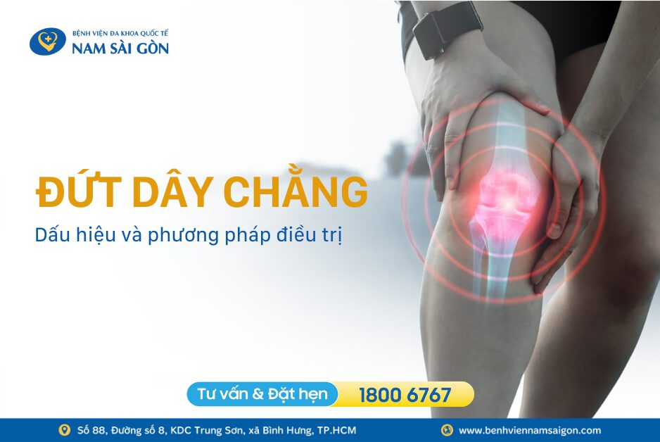 ĐỨT DÂY CHẰNG – NGUYÊN NHÂN, DẤU HIỆU VÀ CÁCH ĐIỀU TRỊ