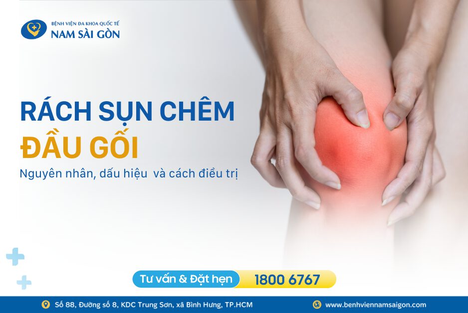 RÁCH SỤN CHÊM ĐẦU GỐI – NGUYÊN NHÂN, DẤU HIỆU VÀ ĐIỀU TRỊ