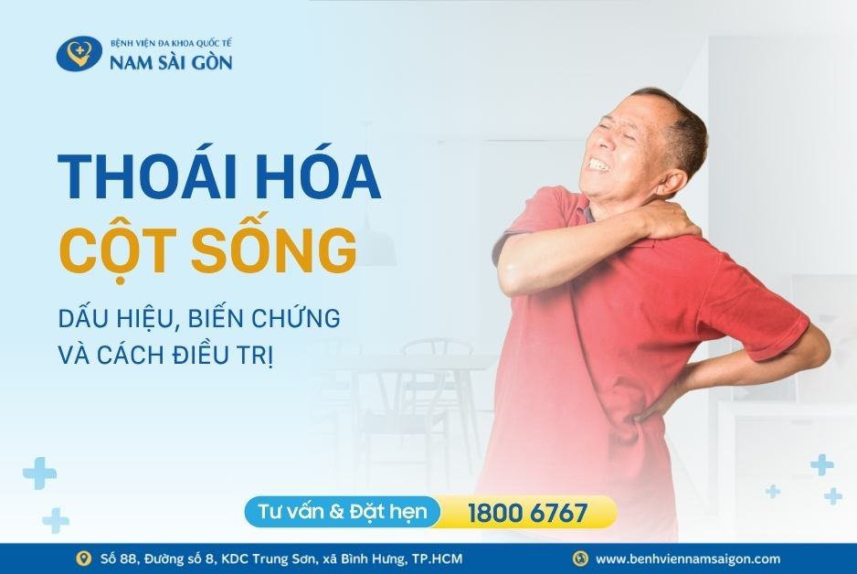 THOÁI HÓA CỘT SỐNG – DẤU HIỆU, BIẾN CHỨNG VÀ CÁCH ĐIỀU TRỊ HIỆU QUẢ