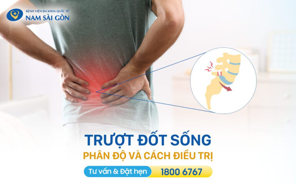 trượt đốt sống là gì