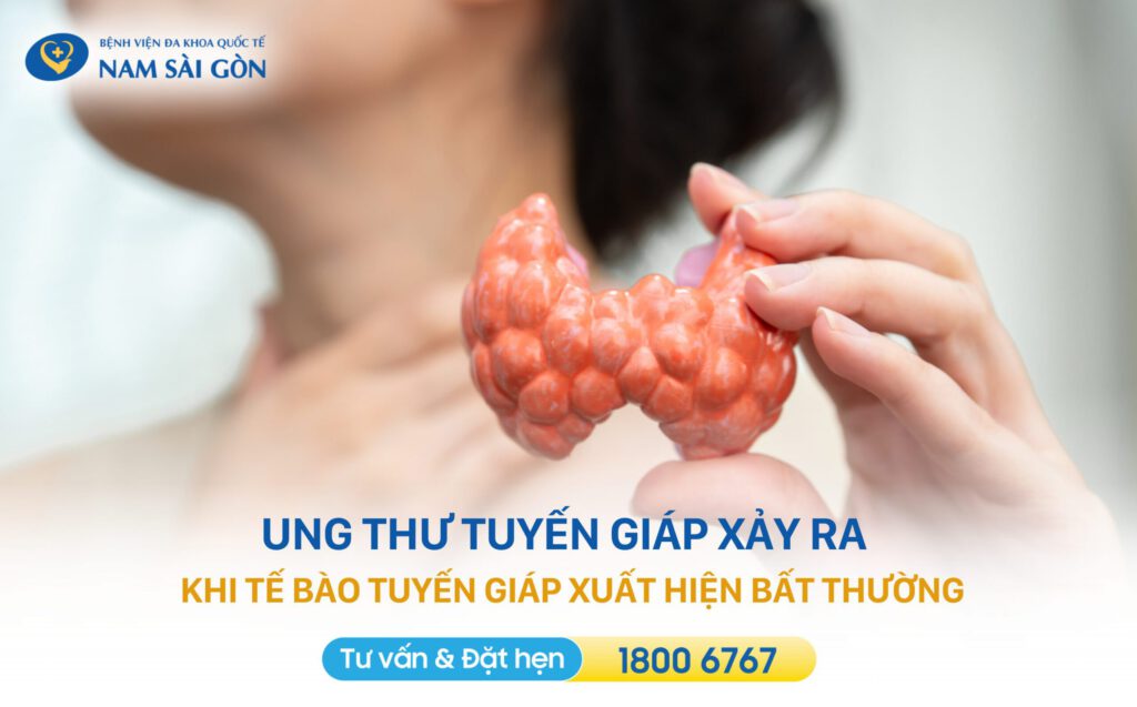ung thư tuyến giáp là gì