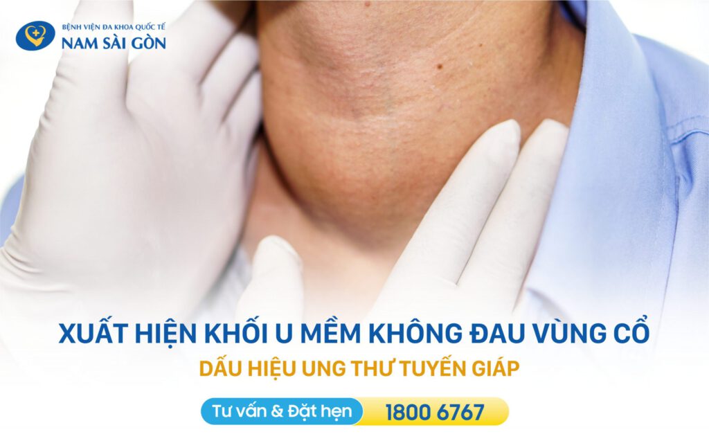 dấu hiệu ung thư tuyến giáp