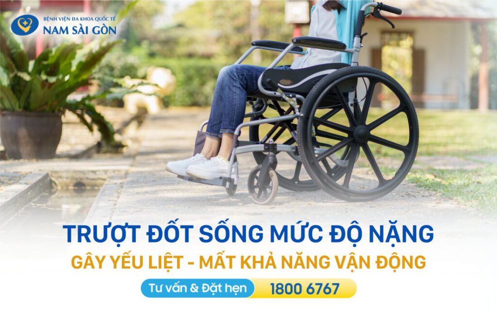Trượt đốt sống lưng có nguy hiểm không