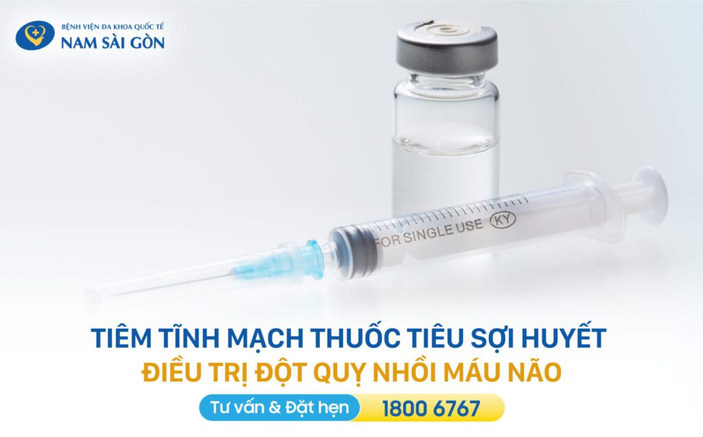 tiêu sợi huyết điều trị đột quỵ do tắc nghẽn cục bộ