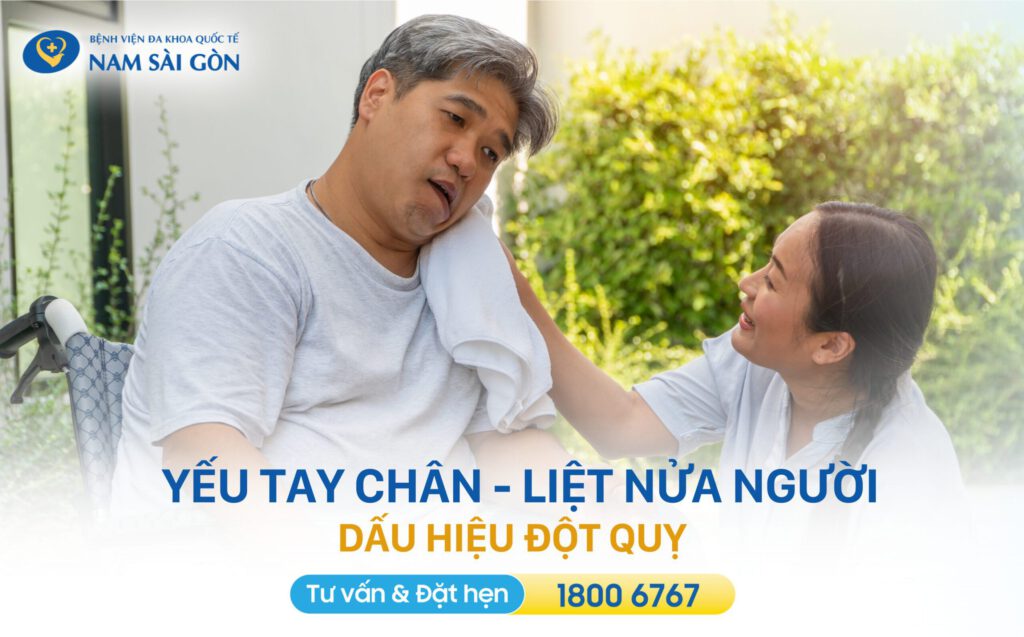 liệt nửa người là dấu hiệu đột quỵ thường gặp
