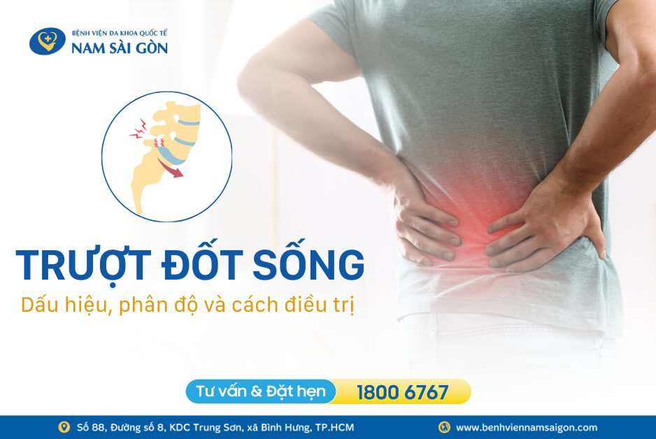 TRƯỢT ĐỐT SỐNG – DẤU HIỆU, PHÂN ĐỘ VÀ CÁCH ĐIỀU TRỊ
