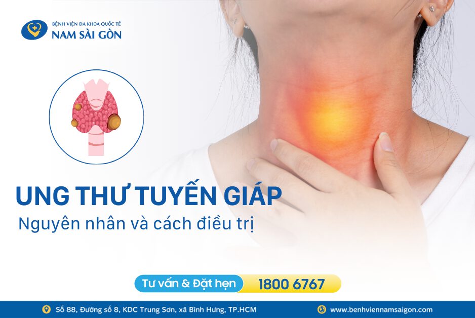 UNG THƯ TUYẾN GIÁP – NGUYÊN NHÂN VÀ CÁCH ĐIỀU TRỊ